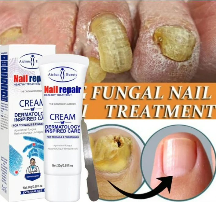 Nail repair - Anti Hongos crema