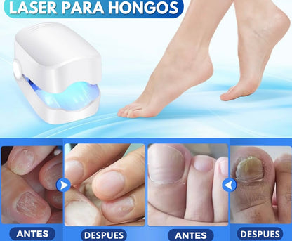 Laser para Uñas con Luz UV Dermolaser