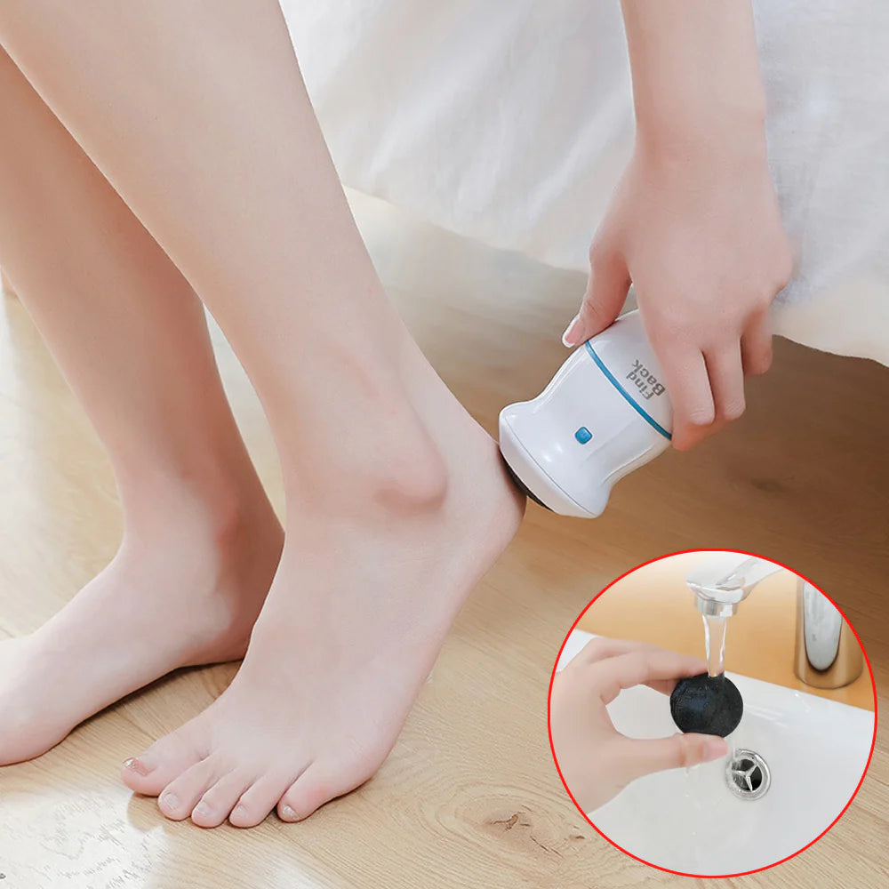 Removedor Eléctrico de Callos CleanFoot™
